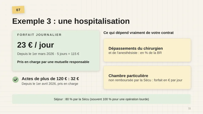 Forfait journalier : 23 € par jour depuis le 1er mars 2026, 5 jours = 115 €, pris en charge par une mutuelle responsable. Actes de plus de 120 € : 32 € depuis le 1er avril 2026, pris en charge. Ce qui dépend vraiment de votre contrat : les dépassements du chirurgien et de l’anesthésiste, en % de la BR ; la chambre particulière, non remboursée par la Sécu, forfait en € par jour. Séjour : 80 % par la Sécu (souvent 100 % pour une opération lourde).